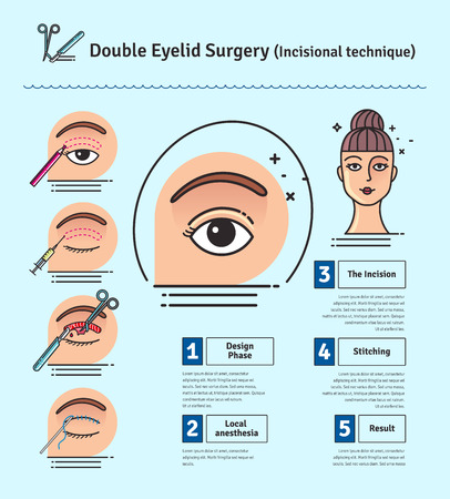 Vector Illustrated set with double eyelid surgery. Infographics with icons of plastic surgery procedures.のイラスト素材