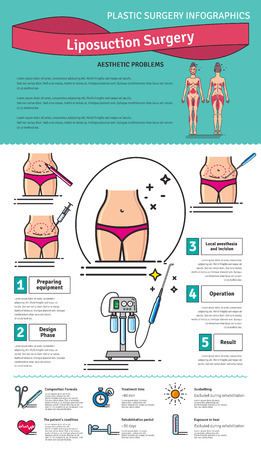 Illustrated set with liposuction surgery. Infographics with icons of plastic surgery procedures.のイラスト素材