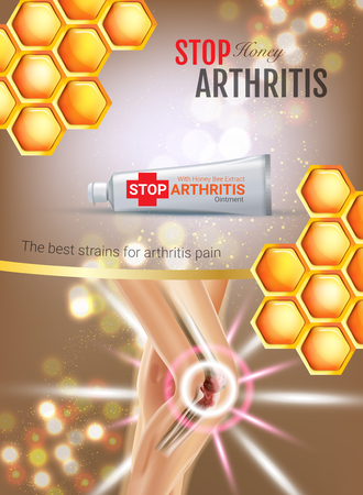 Arthritis Pain Relief Ointment ads. Vector 3d Illustration with Tube cream with honey extract. Vertical poster with product's package.のイラスト素材