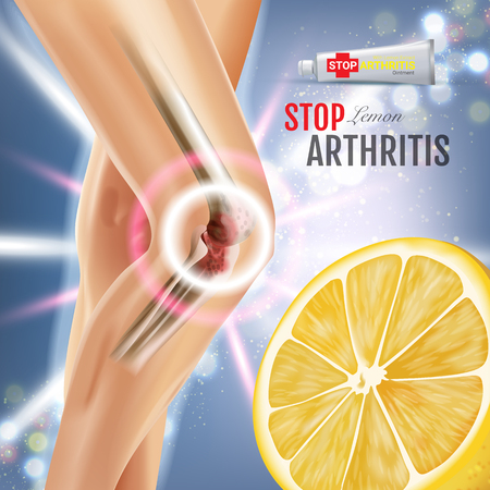 Arthritis Pain Relief Ointment ads. Vector 3d Illustration with Tube cream with lemon extract. Poster with product's package.のイラスト素材