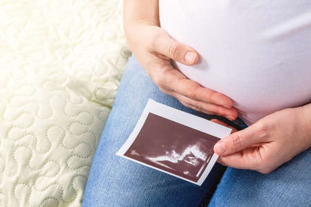 Pregnant woman sitting on bed. One hand hugs her tummy and in other holds ultrasound photo of future...