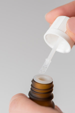 Cure for warts. Bottle with medicine for the treatment of warts in the hands of a woman close-up....