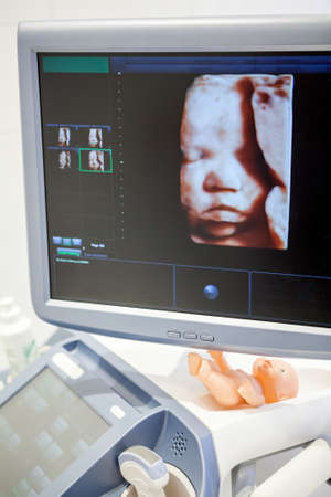 Model of image of mature fetus is on ultrasonographer monitor screen, face of baby, close up viewの写真素材