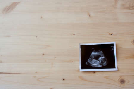 Sonogram on Woodの写真素材