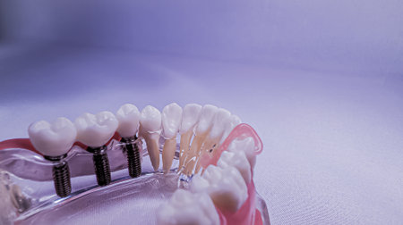 Implants Macro Inner View of Mandibular Dental Model Showing Roots and Fixturesの写真素材