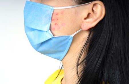 mask and facial skin problems