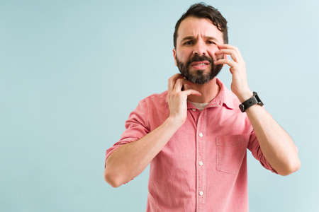 Stressed hispanic man scratching his face and neck due to an allergic reaction. Upset man with dermatological problemsの写真素材