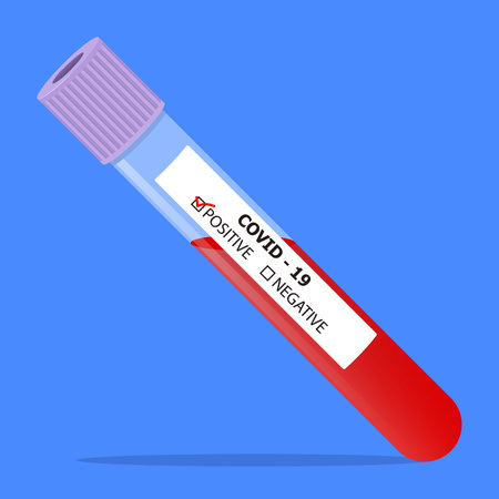 Blood test for coronavirus COVID-19. Vector illustration.のイラスト素材