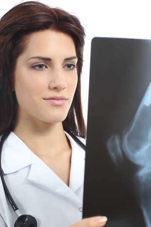 Beautiful doctor woman looking a radiography of a knee isolated on a white backgroundの写真素材