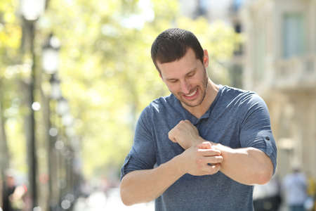 Overwhelmed adult man scratching itchy arm standing in the streetの写真素材