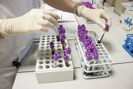 Milan, Italy - March 17, 2020: Operators Sorting of blood tubes in a rack in the analysis laboratory