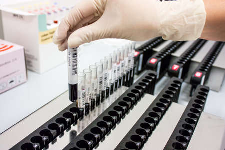 Milan, Italy - November 18, 2020: Operators Sorting of blood tubes in a rack in the analysis laboratoryのeditorial素材