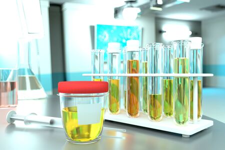 Urine sample test for parasites or blood in urine hematuria - laboratory test-tubes in modern pharmaceutical clinic, medical 3D illustrationの写真素材