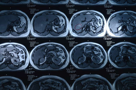 body x-rayの写真素材