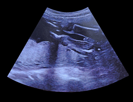 Obstetric Ultrasound of fetus at five month. Echography Scan.の写真素材