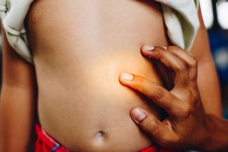 Female hands used by patients with mosquito repellant ,,Blister caused by insect bite and mother take careの写真素材