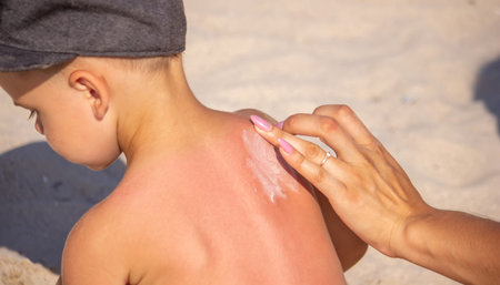 Mom puts sunscreen on Sin's back in the shape of a heart. selective focus