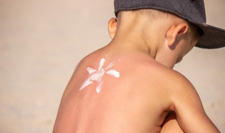 Mom applies suntan cream to her blue back. selective focus
