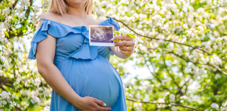Pregnant woman in the garden of flowering apple trees ultrasound. selective focus. Nature.