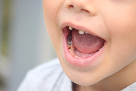 a boy without a tooth. Selective focus. natureの写真素材