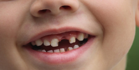 The child lost a tooth. Selective focus. Kid.Concept baby toothの写真素材