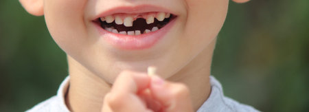 The child lost a tooth. Selective focus. Kid.Concept baby tooth