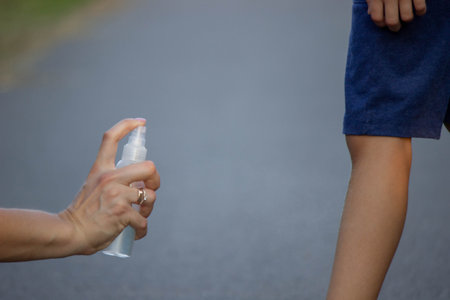 woman applies insect repellent to her son's hand in the park, close-up. Prevention of bites.の写真素材