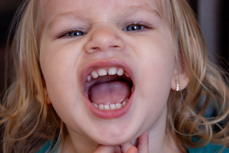 Beautiful and healthy baby teeth in a little girl. The baby's mouth with a milk tooth.