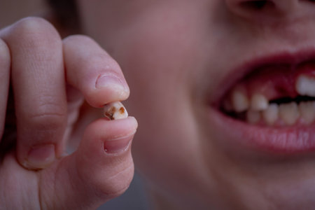 A child has lost a baby tooth. Kid.Concept baby tooth.の写真素材