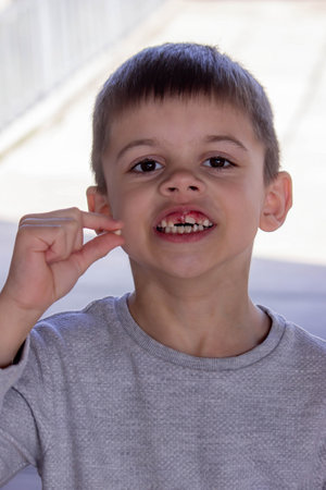 A child has lost a baby tooth. Kid.Concept baby tooth.の写真素材