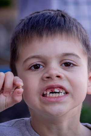 A child has lost a baby tooth. Kid.Concept baby tooth.の写真素材