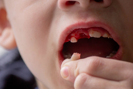 A child has lost a baby tooth. Kid.Concept baby tooth.の写真素材