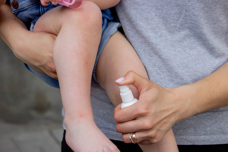Scratches on a child's leg. small child
