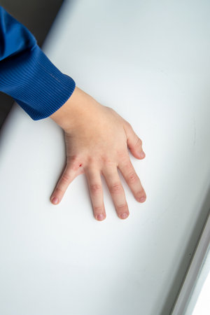 Skin rashes, allergies contact dermatitis, allergic to chemicals.の写真素材