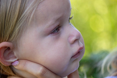 Little girl has allergies. Swollen eyes