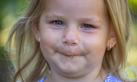 The girl has allergies. Snotの写真素材