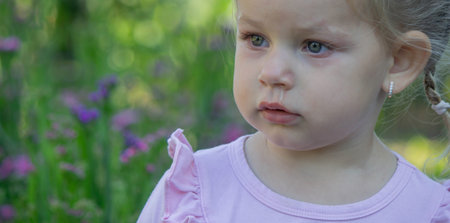 Sad little girl with allergy symptoms outdoors.の写真素材