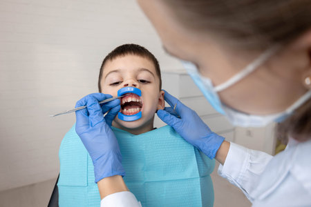 Child dental checkup with mouth retractor. Pediatric dentistry concept.
