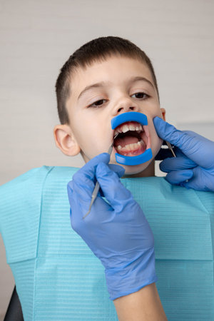 Child dental checkup with mouth retractor. Pediatric dentistry concept.
