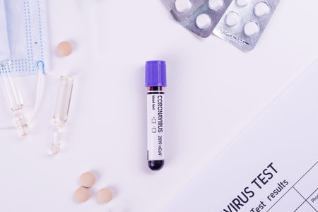 Blood test semple in lab. Coronavirus 2019-nCoV concept still life with blood test and drugs. COVID-19 background.の写真素材