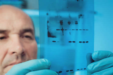 Scientist checks results of Western Blot experimentの写真素材