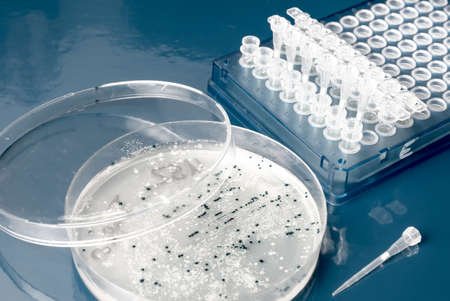 Bacterial colonies for cloning of transgenic into plasmid DNAの写真素材