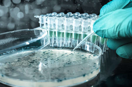 Scientist picks up bacterial colonies for cloning of transgenic into plasmid DNAの写真素材