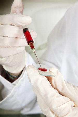 Young lab worker doing tests with blood