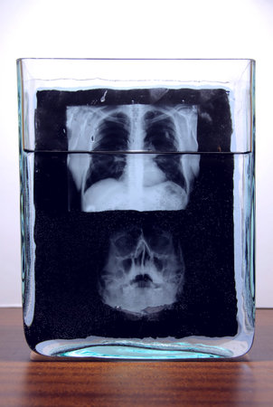 Human skull and lungs x ray scanning image