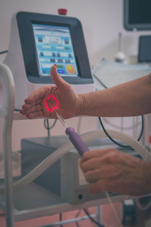 Female doctor is holding a laser used for vaginal treatment of incontinence, Visible ray of laser...