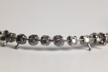 Macro photo of dental braces without teeth, dismounted from mouth, nobody on the picture. Dental...