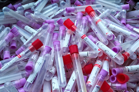 Many laboratory tubeの写真素材