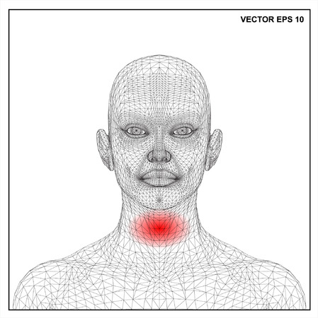 Vector concept 3D wireframe Cartoon female, Medical illustration showing inflamed, painful.のイラスト素材