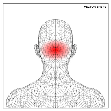 Vector concept 3D wireframe Cartoon female, Medical illustration showing inflamed, painful.のイラスト素材
